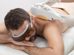 Professional Laser Hair Removal for Men | Laser Den