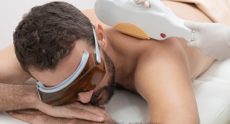 Professional Laser Hair Removal for Men ...
