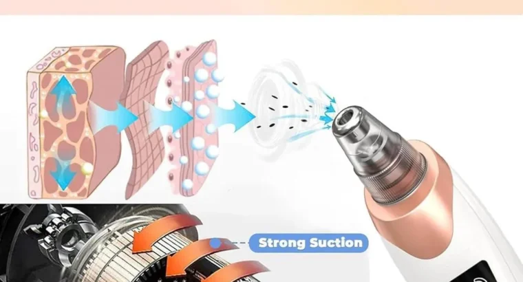 5-in-1 Electric Blackhead