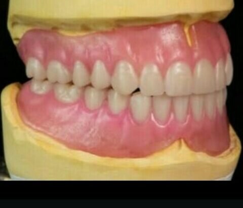 DENTUR making and repair at home visit