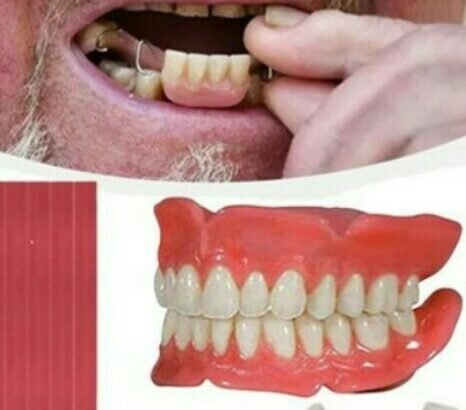 DENTUR making and repair at home visit