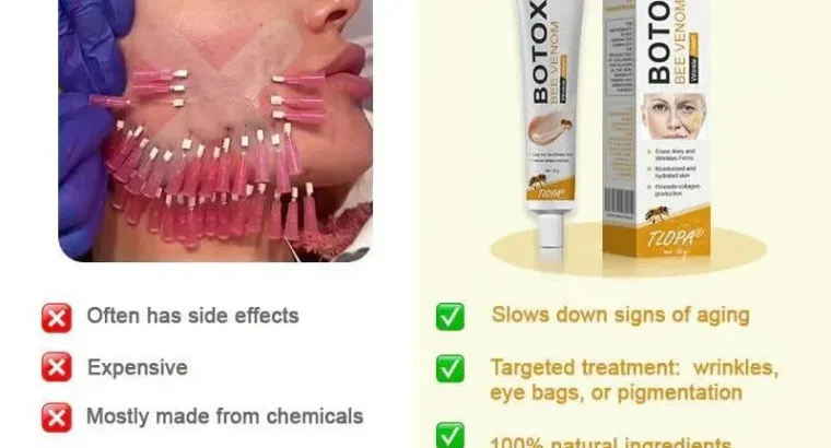 Say Goodbye to Acne Scars