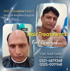 hair wig, hair unit, hair extensions, hair cap, hair Patch