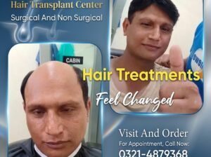 hair wig, hair unit, hair extensions, hair cap, hair Patch