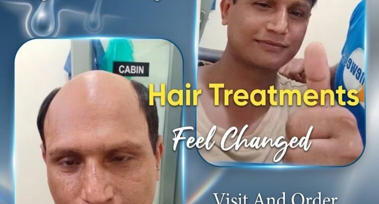 hair wig, hair unit, hair extensions, ha...